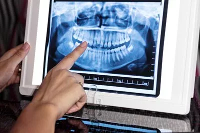 dentist reviewing a patient's dental x-rays